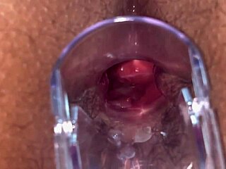 Speculum examination of the anus and the gaping hole