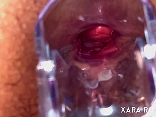 Speculum examination of the anus and the gaping hole
