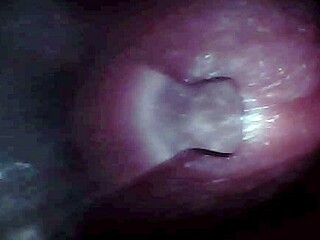 No input for 818954, skipping.