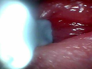Endoscope camera recorded a man's hot sperm jetting out