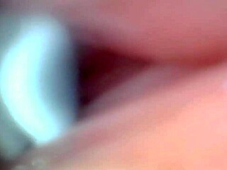 Endoscope camera recorded a man's hot sperm jetting out