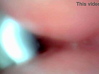 Endoscope camera recorded a man's hot sperm jetting out