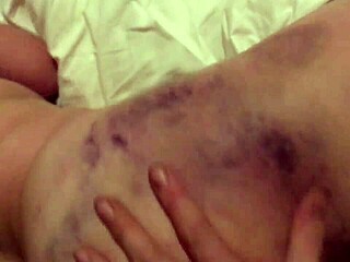 Dominant Partner Films Intense Chubby Submissive Getting Messed Up and Bruised in Kinky BDSM Session